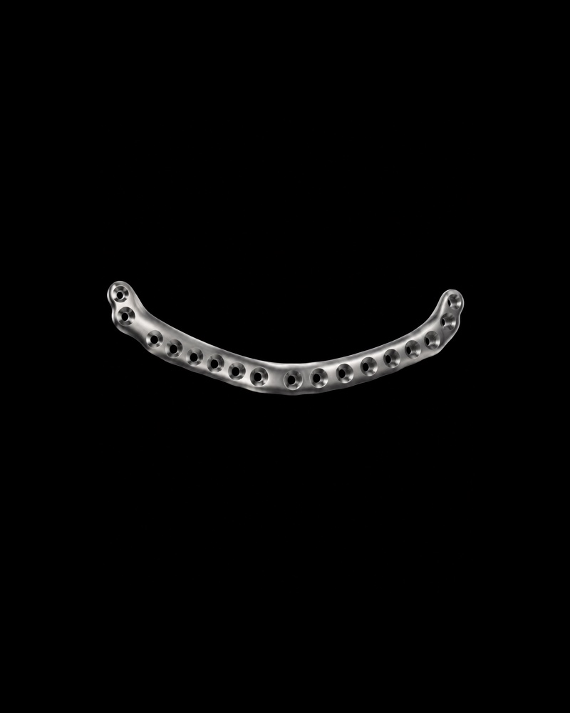 Reconstruction plate. A stronger plate for a badly broken jaw.