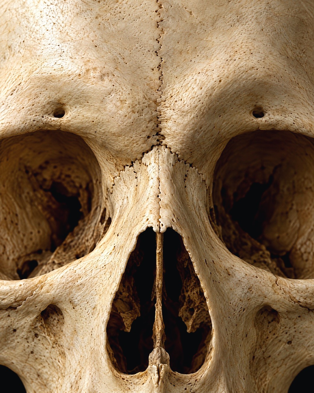 Close-up of the nasal bones and nasal opening of a human skull.
